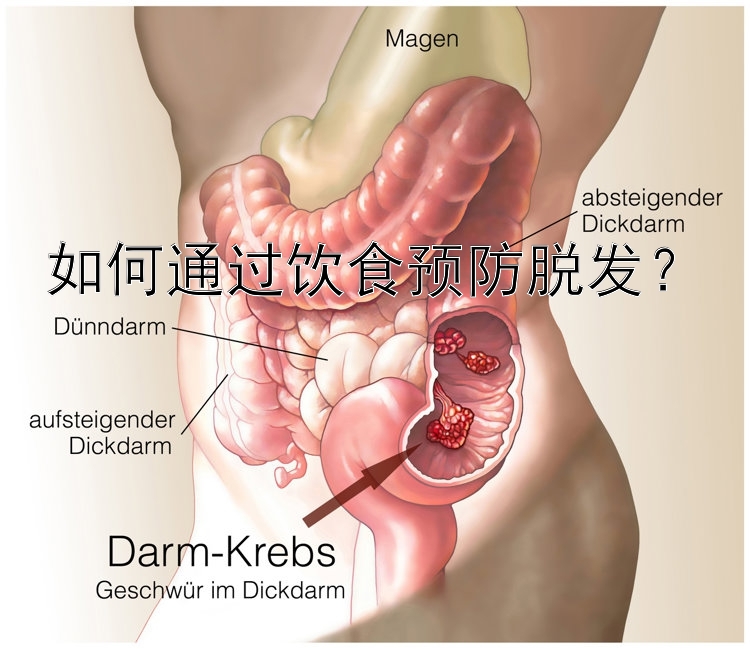 北京pk10如何通过饮食预防脱发？