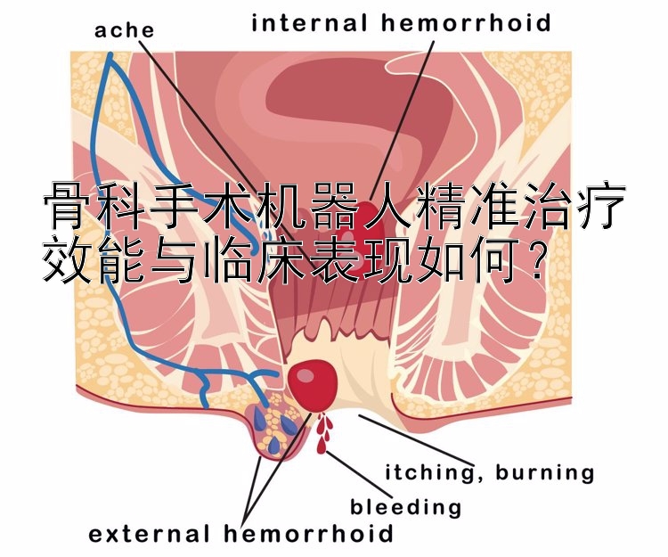 骨科手术机器人精准治疗效能与临床表现如何？