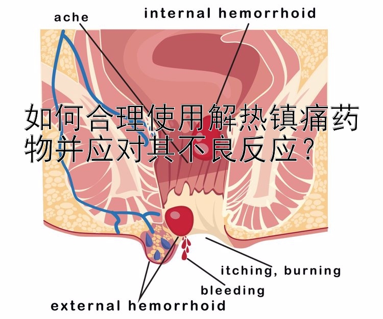 如何合理使用解热镇痛药物并应对其不良反应？