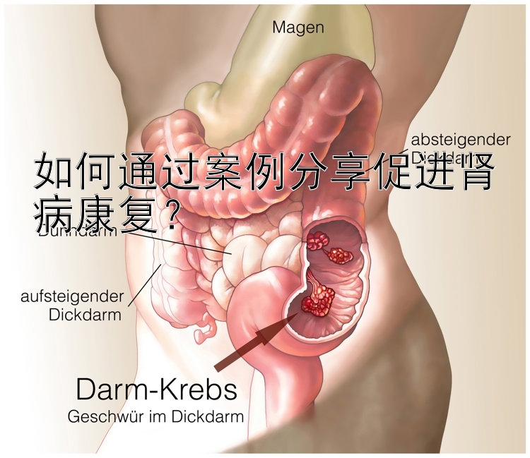 如何通过案例分享促进肾病康复？