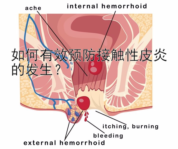 如何有效预防接触性皮炎的发生？