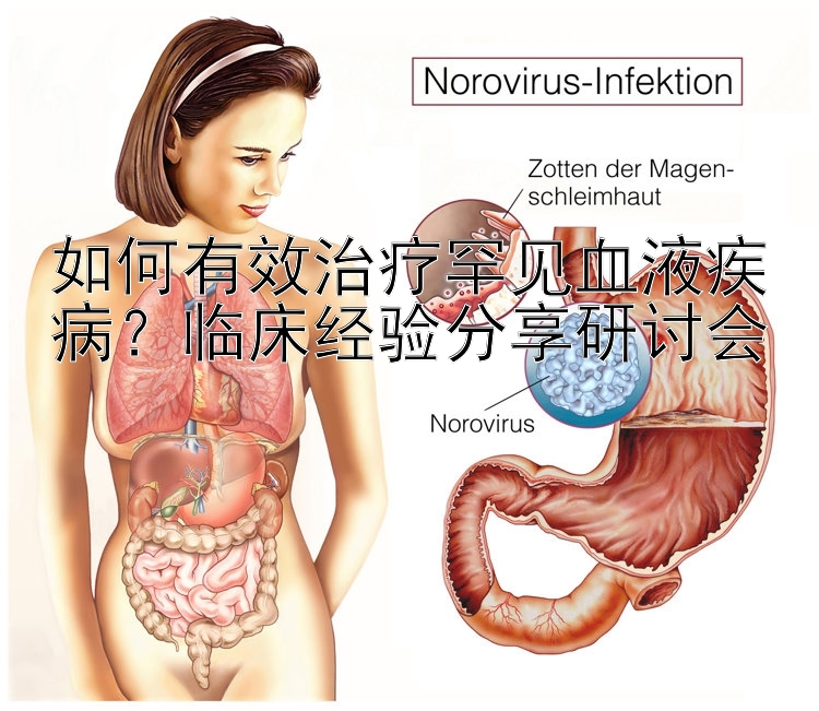 如何有效治疗罕见血液疾病？临床经验分享研讨会