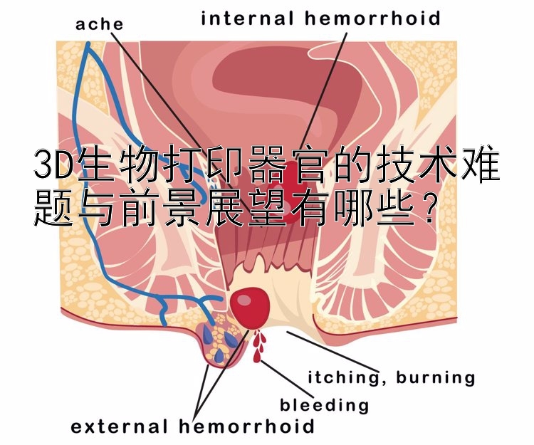 3D生物打印器官的技术难题与前景展望有哪些？