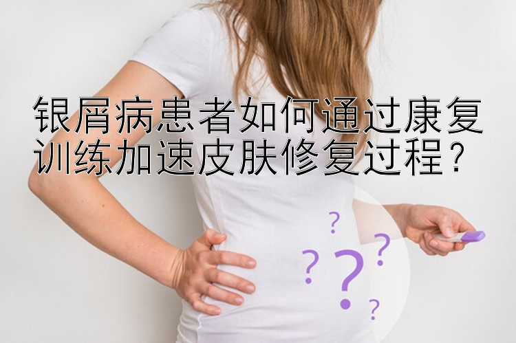 银屑病患者如何通过康复训练加速皮肤修复过程？