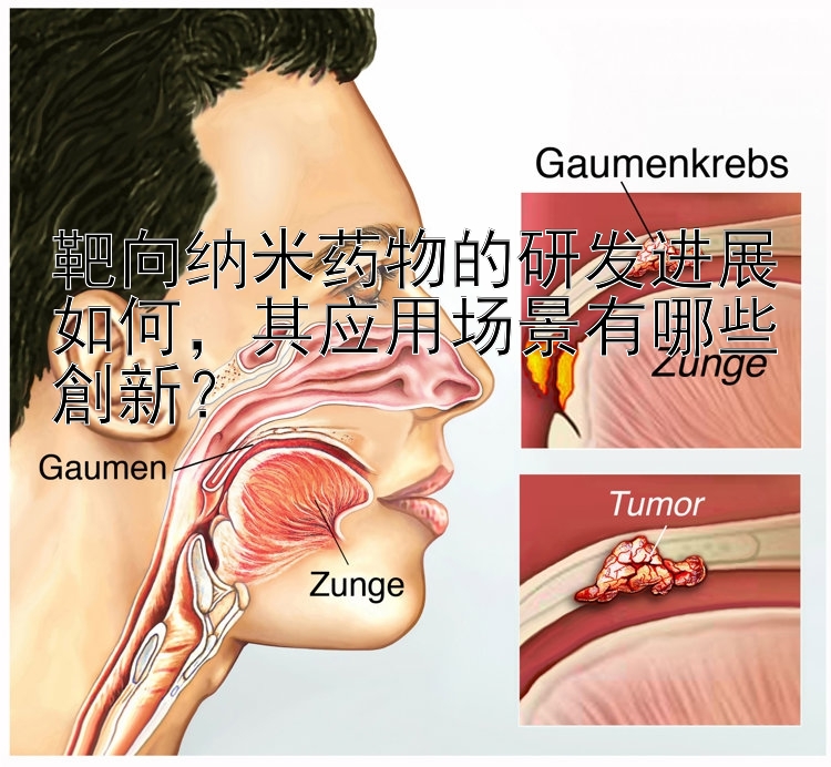 靶向纳米药物的研发进展如何，其应用场景有哪些創新？