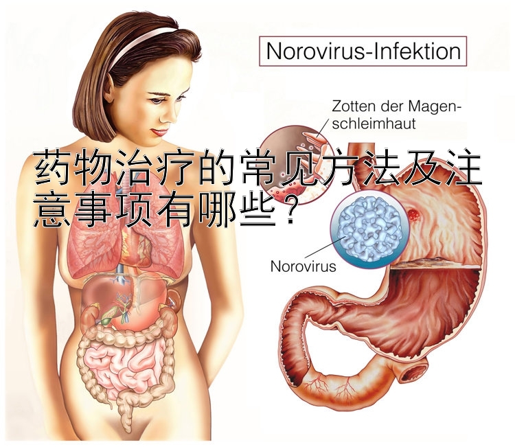 药物治疗的常见方法及注意事项有哪些？