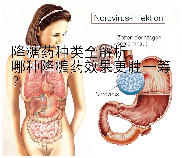 降糖药种类全解析  
哪种降糖药效果更胜一筹？