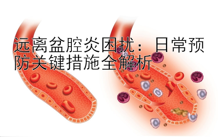 远离盆腔炎困扰：日常预防关键措施全解析