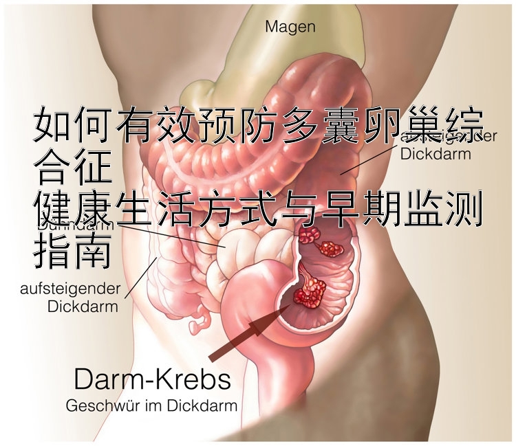 如何有效预防多囊卵巢综合征  
健康生活方式与早期监测指南