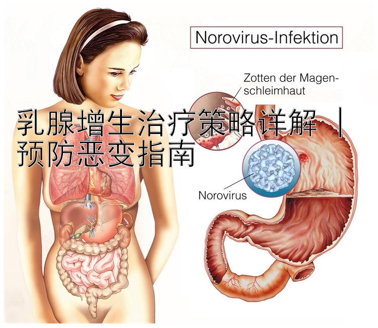 乳腺增生治疗策略详解 | 预防恶变指南