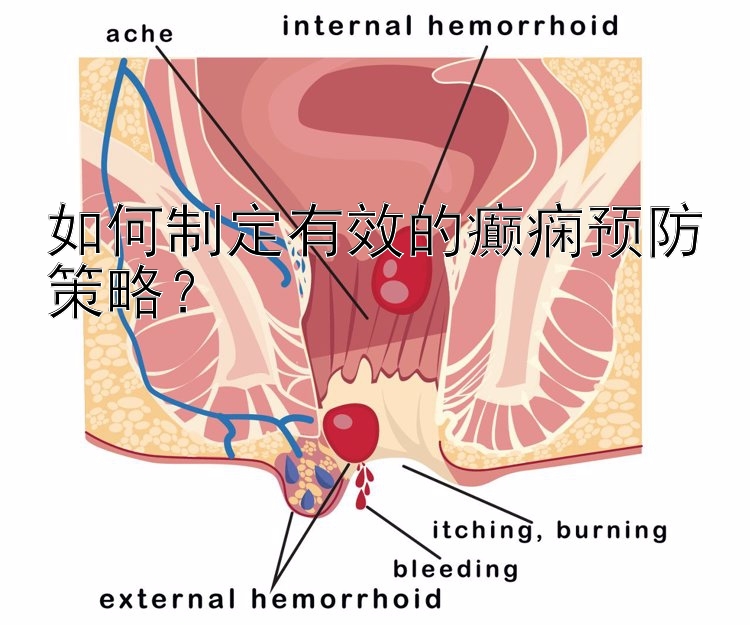 如何制定有效的癫痫预防策略？