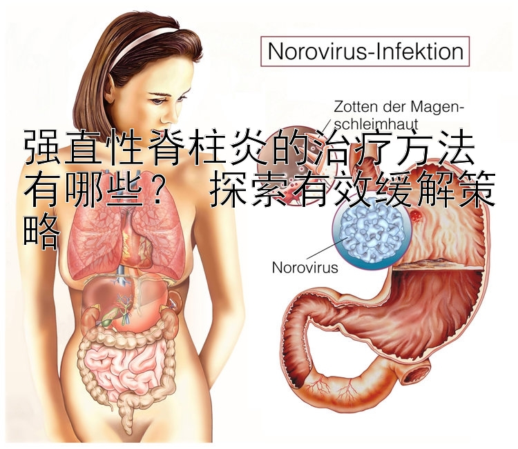 强直性脊柱炎的治疗方法有哪些？ 探索有效缓解策略