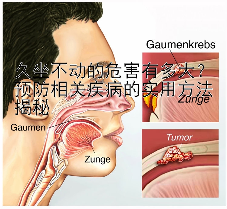 久坐不动的危害有多大？预防相关疾病的实用方法揭秘