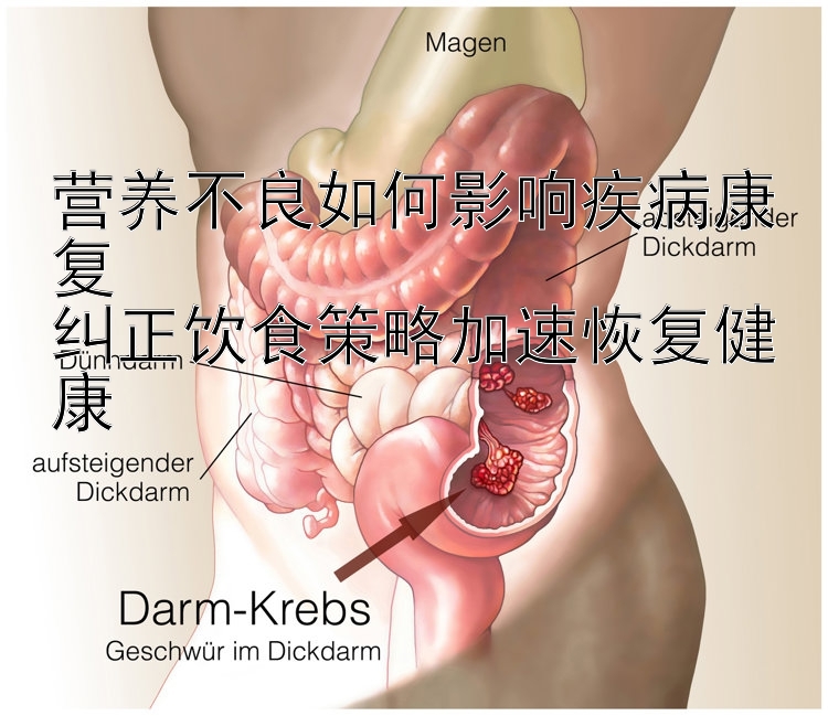 营养不良如何影响疾病康复  
纠正饮食策略加速恢复健康