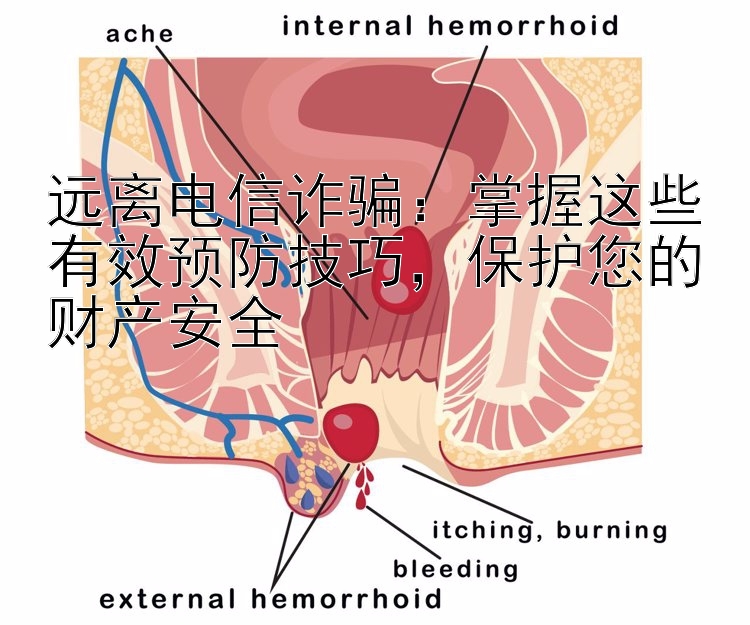 远离电信诈骗：掌握这些有效预防技巧，保护您的财产安全