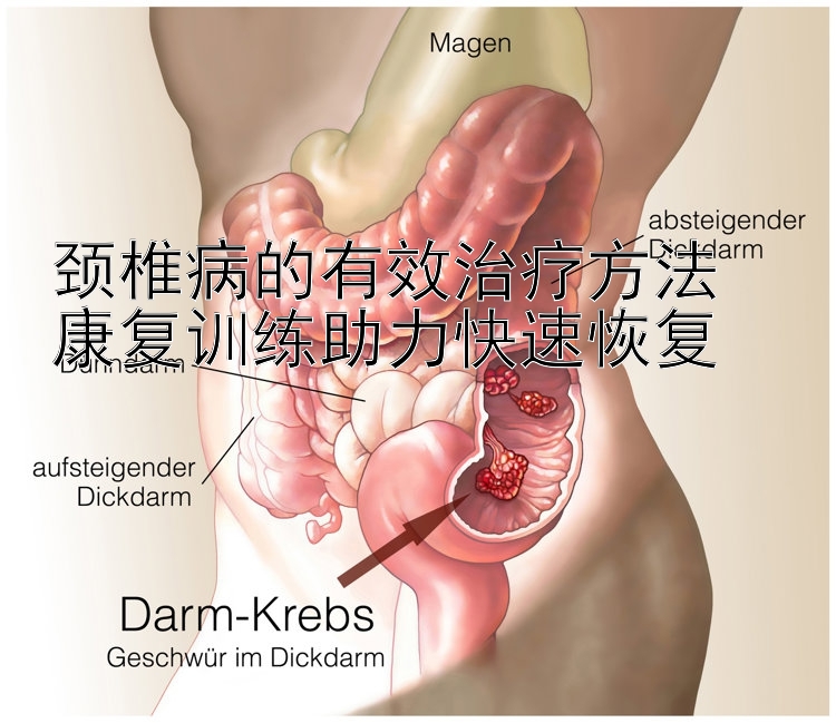 颈椎病的有效治疗方法  
康复训练助力快速恢复