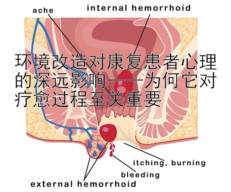 环境改造对康复患者心理的深远影响——为何它对疗愈过程至关重要