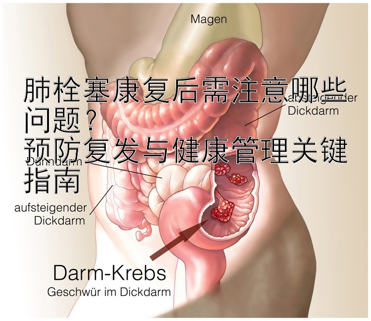 肺栓塞康复后需注意哪些问题？  
预防复发与健康管理关键指南