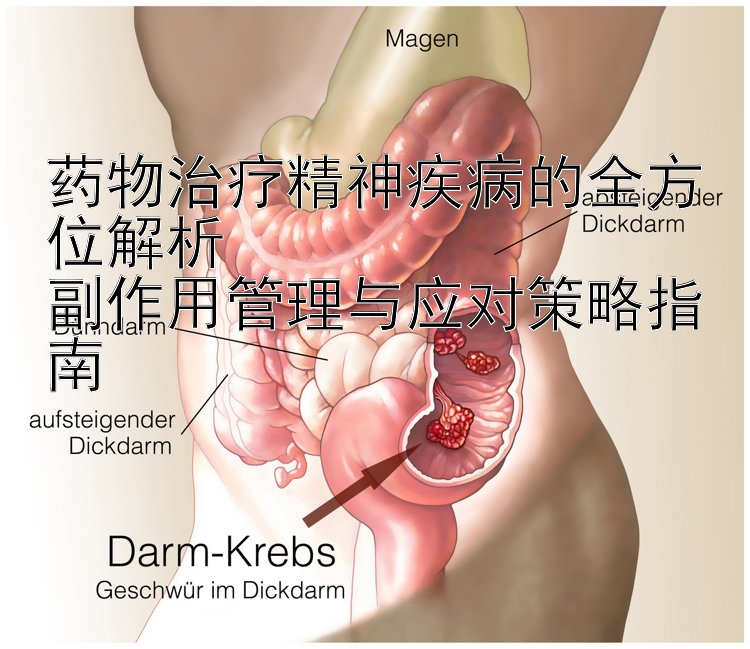 药物治疗精神疾病的全方位解析  
副作用管理与应对策略指南