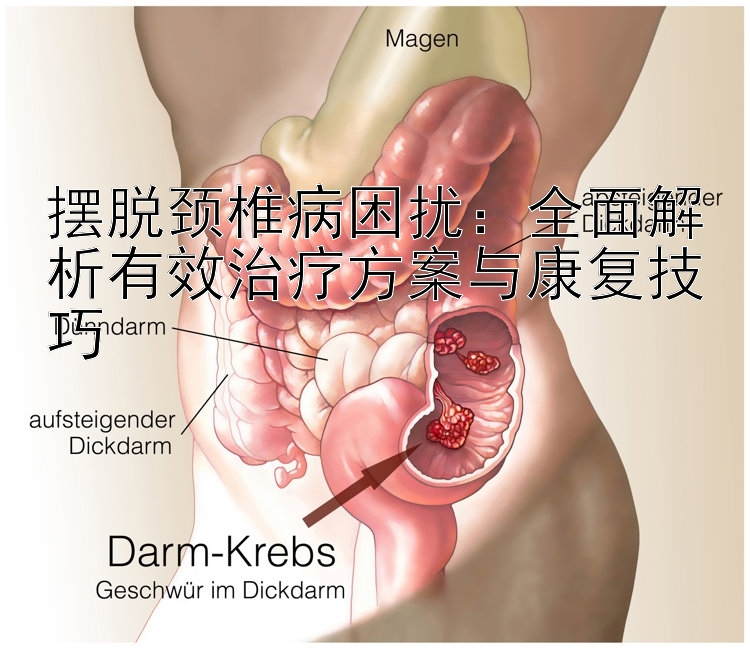 摆脱颈椎病困扰：全面解析有效治疗方案与康复技巧