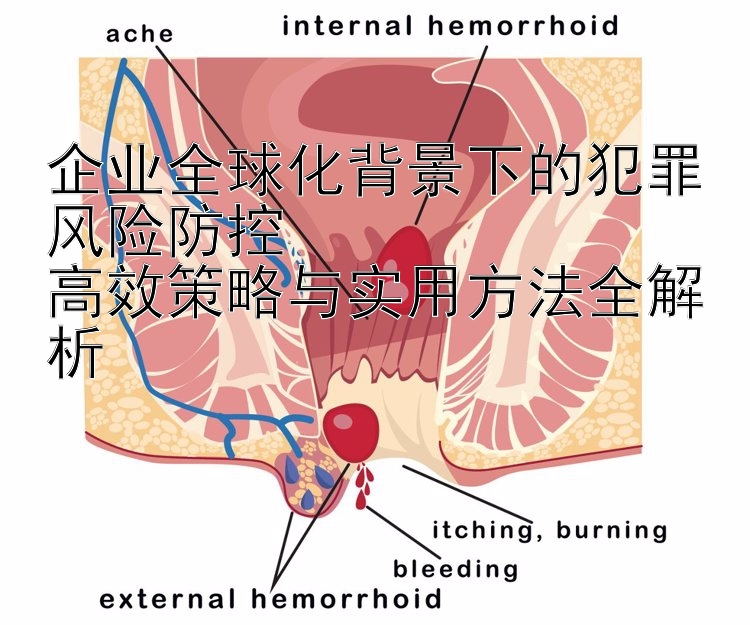 企业全球化背景下的犯罪风险防控  
高效策略与实用方法全解析