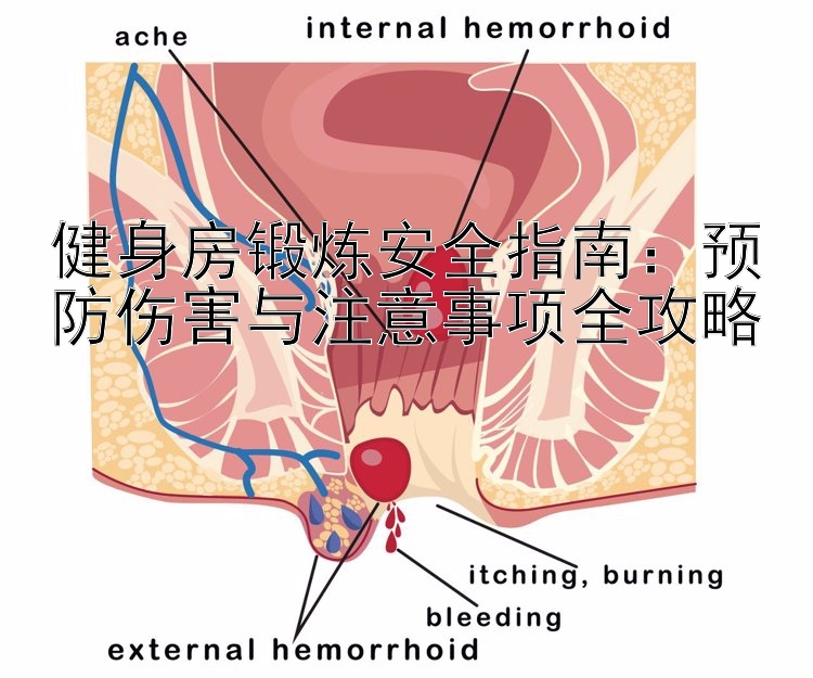 健身房锻炼安全指南：预防伤害与注意事项全攻略