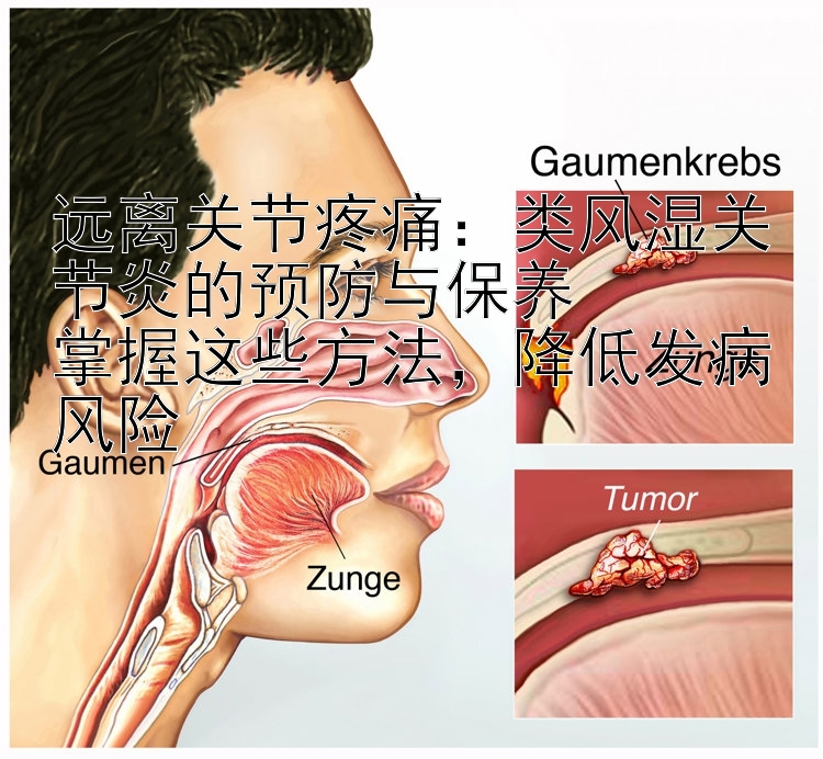 远离关节疼痛：类风湿关节炎的预防与保养  
掌握这些方法，降低发病风险