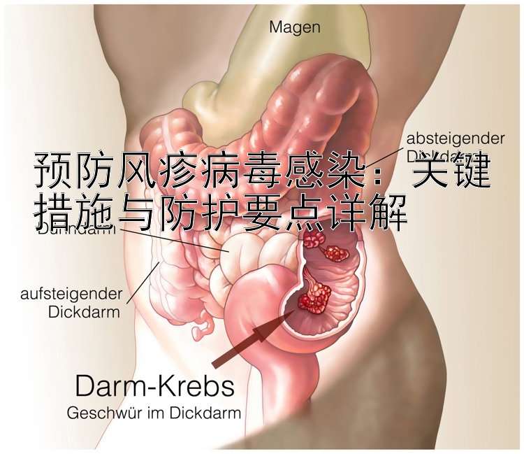 预防风疹病毒感染：关键措施与防护要点详解