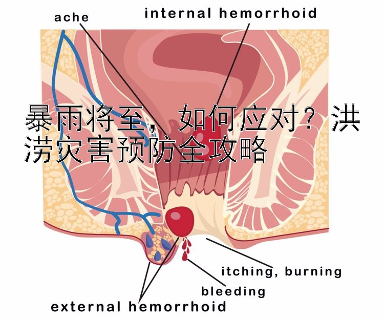 暴雨将至，如何应对？洪涝灾害预防全攻略