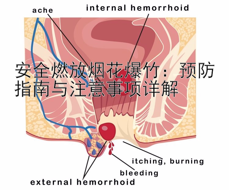 安全燃放烟花爆竹：预防指南与注意事项详解