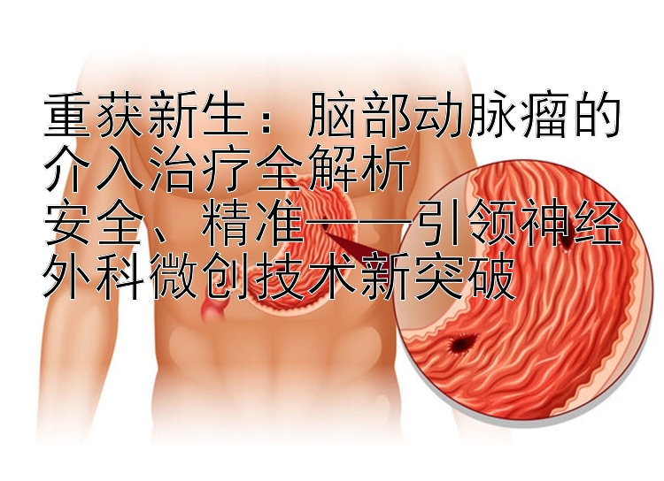 重获新生：脑部动脉瘤的介入治疗全解析  