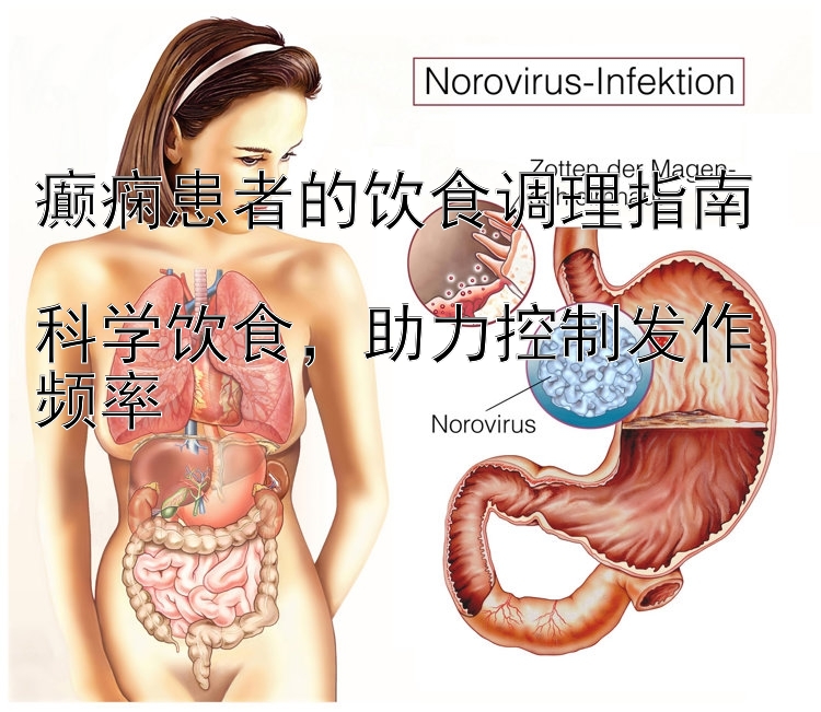 癫痫患者的饮食调理指南  
科学饮食，助力控制发作频率