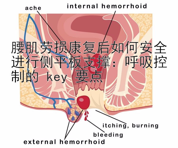 腰肌劳损康复后如何安全进行侧平板支撑：呼吸控制的 key 要点