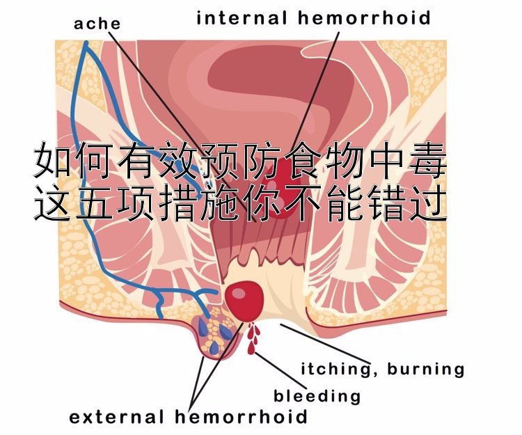 如何有效预防食物中毒  
这五项措施你不能错过