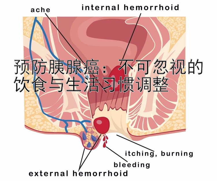 预防胰腺癌：不可忽视的饮食与生活习惯调整