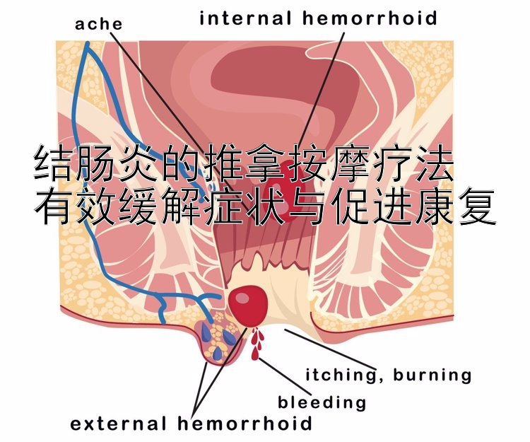 结肠炎的推拿按摩疗法  
有效缓解症状与促进康复